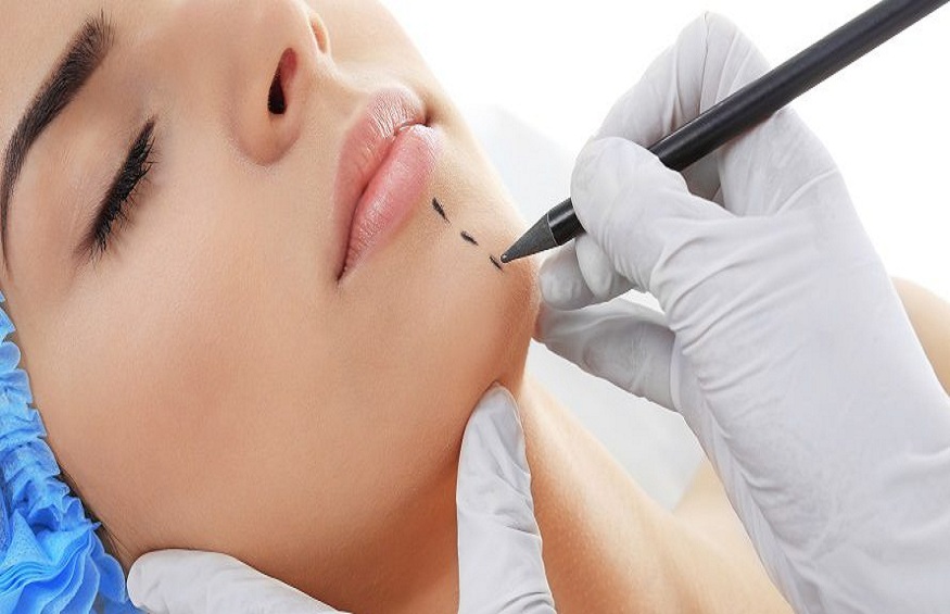 chin implant therapy